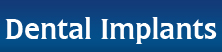 Dental Implants Dental Implants