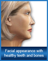 Facial appearance with healthy teeth and bones